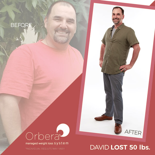 David before and after Orbera treatment | BETB