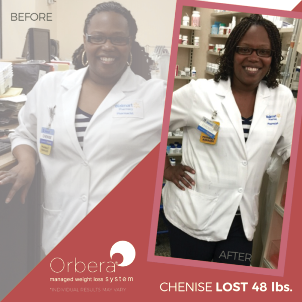 Chenise before and after Orbera treatment | BETB