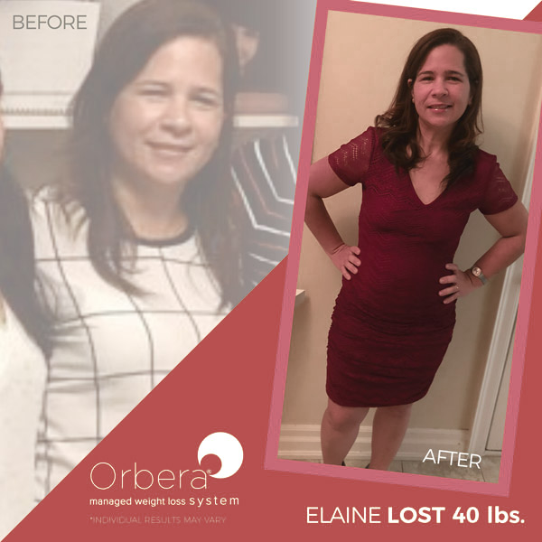 Elaine before and after Orbera treatment | BETB